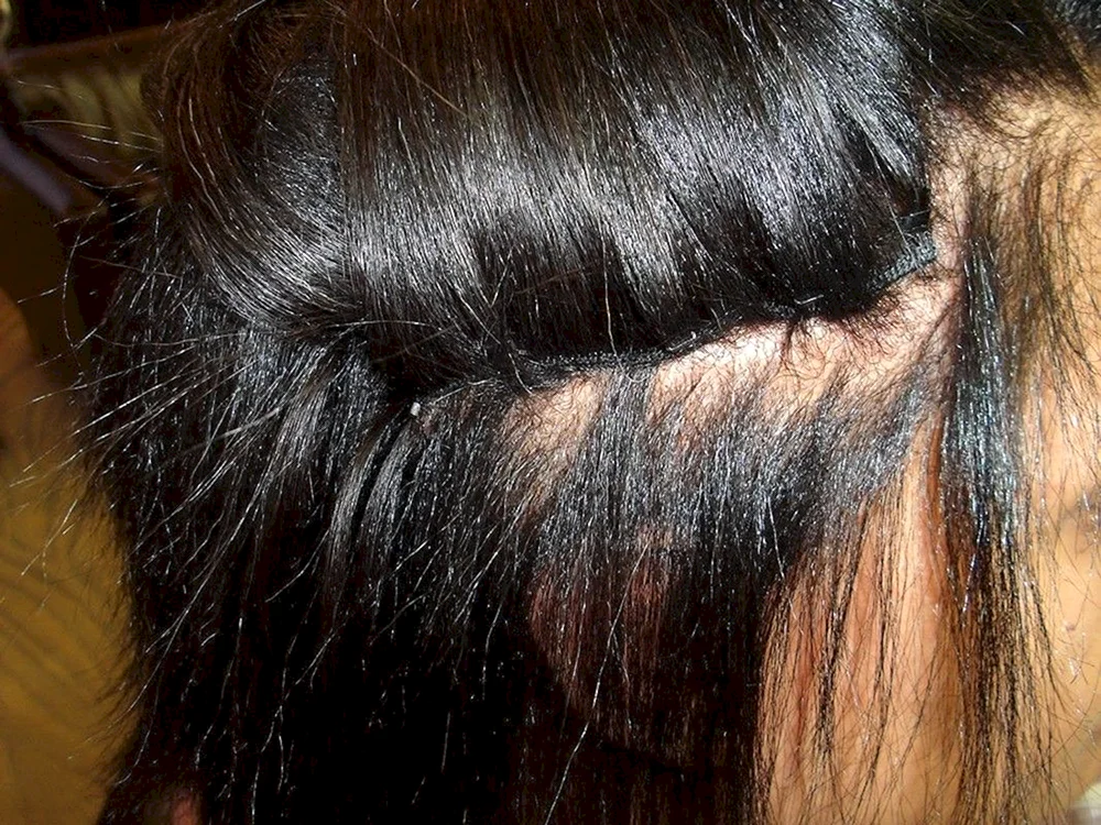 Braune Haare