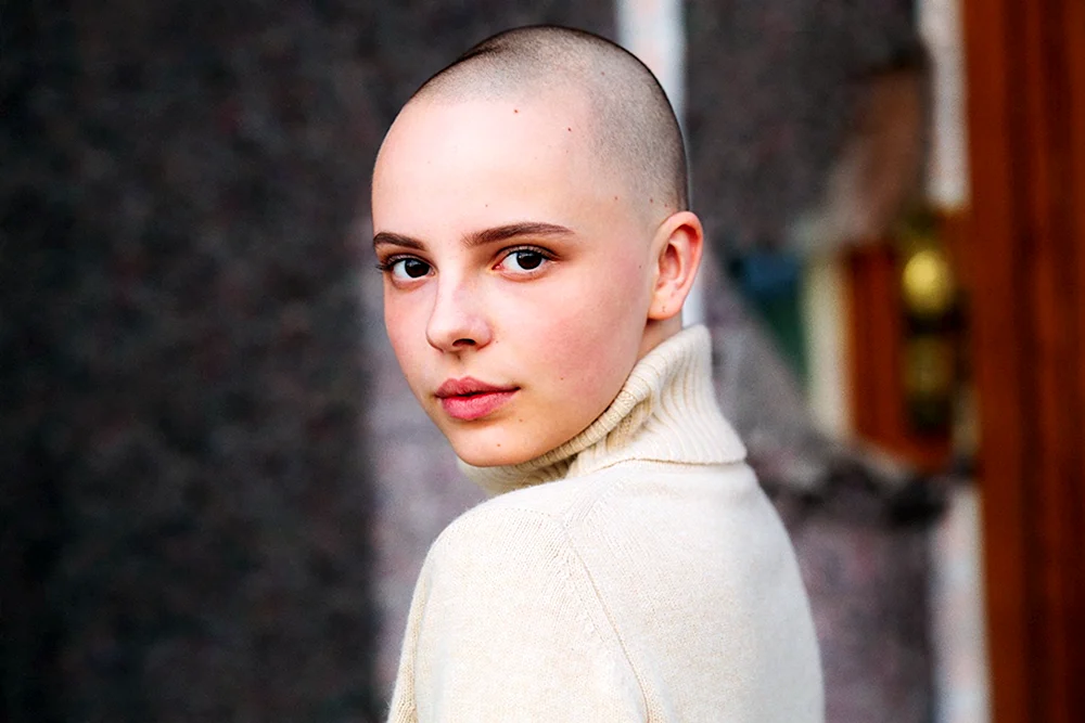 Natasha Whiteman mit Glatze