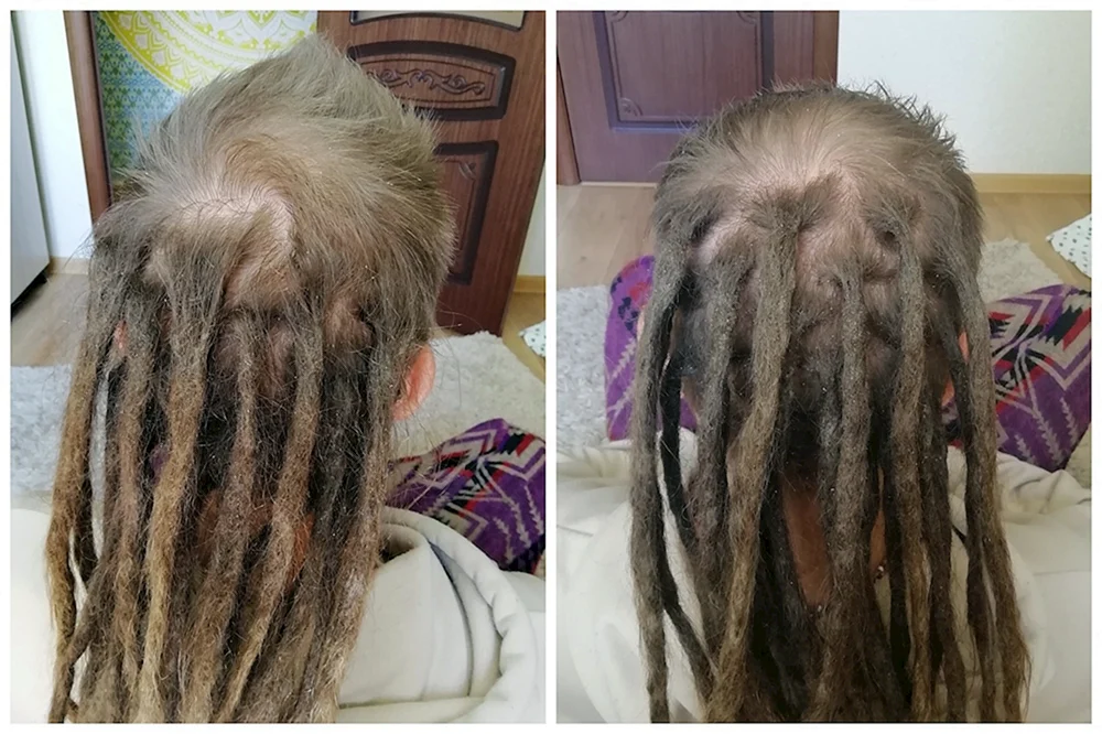 De Dreadlocks 40 cm