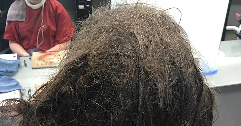 Ungepflegtes Haar