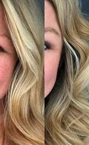 gebleichtes Haar