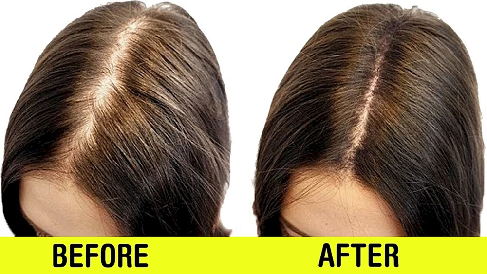 Vor und nach dem Haarschnitt
