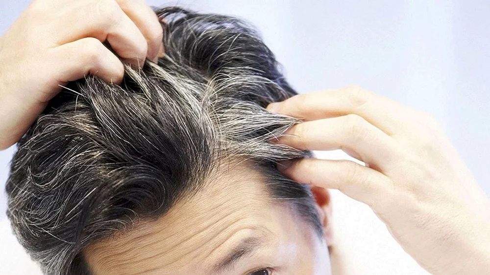 Graue Haare