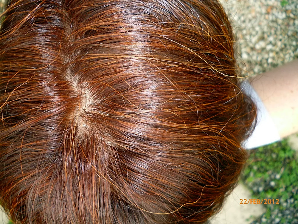 Henna zum Färben von grauem Haar