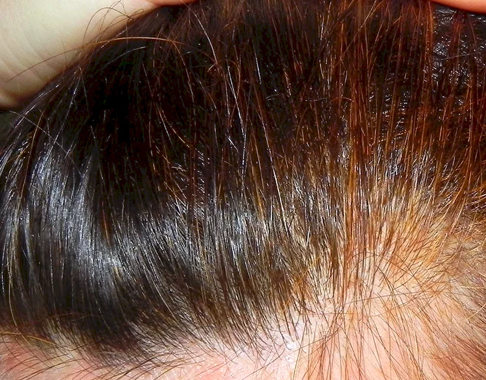 Henna zum Färben von grauem Haar