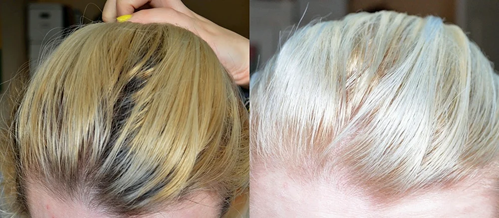 Haarfärbung nach Bleaching