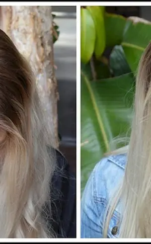 Glatzenbildung bei blondem Haar