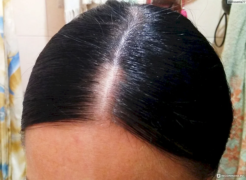 Blonde Wurzeln auf schwarzem Haar