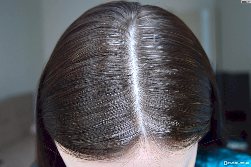 Graue Haare färben