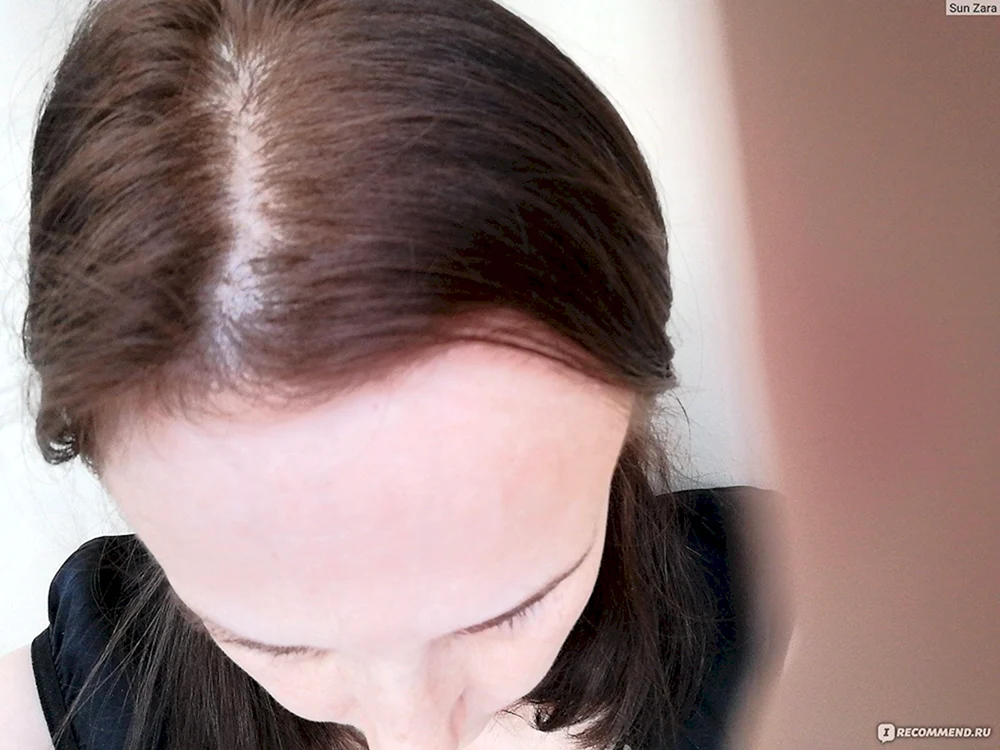 Blonde Wurzeln auf schwarzem Haar