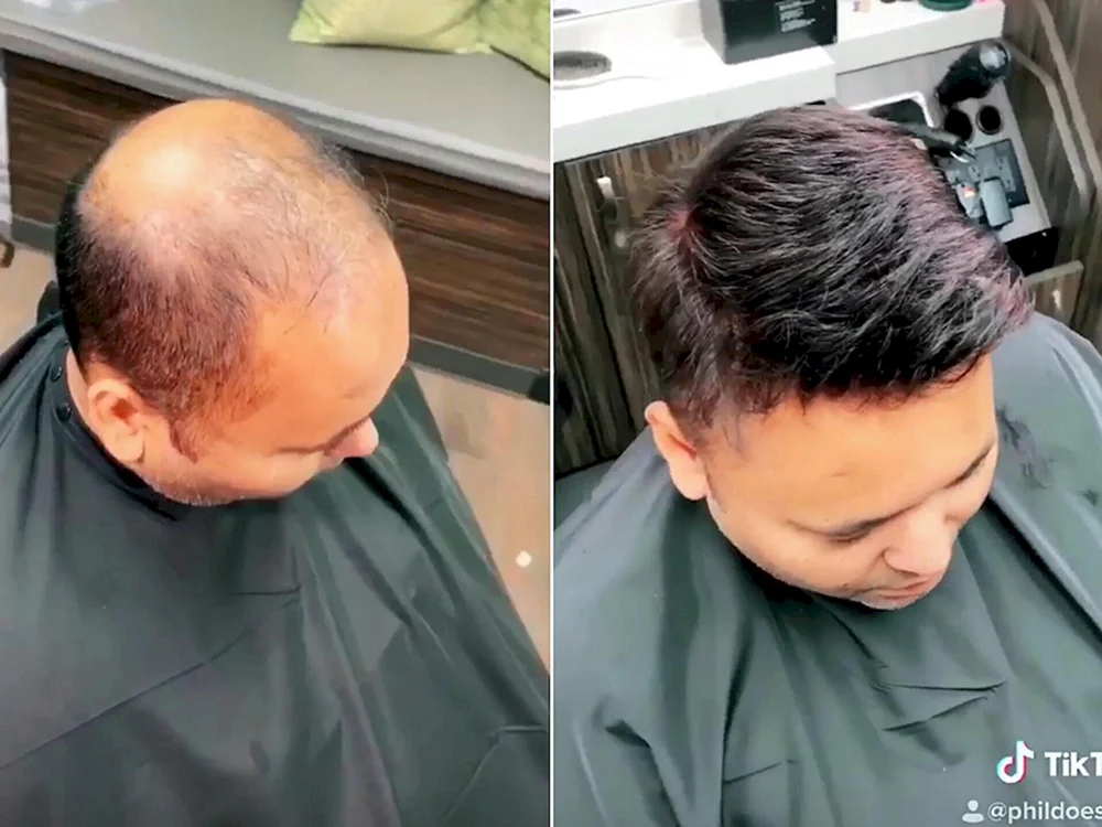 Frisuren für Männer mit Glatze