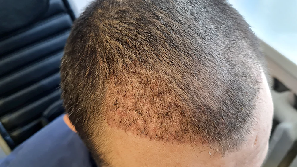 Fade Haarschnitt Kanadischer Undercut