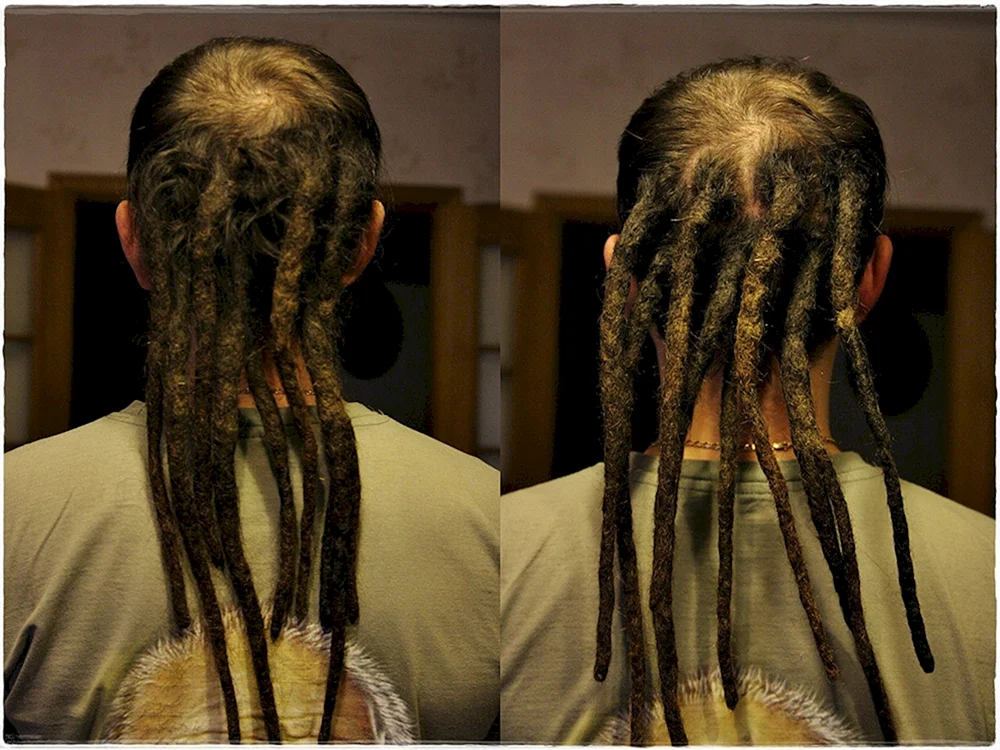 Dreadlockflechtung