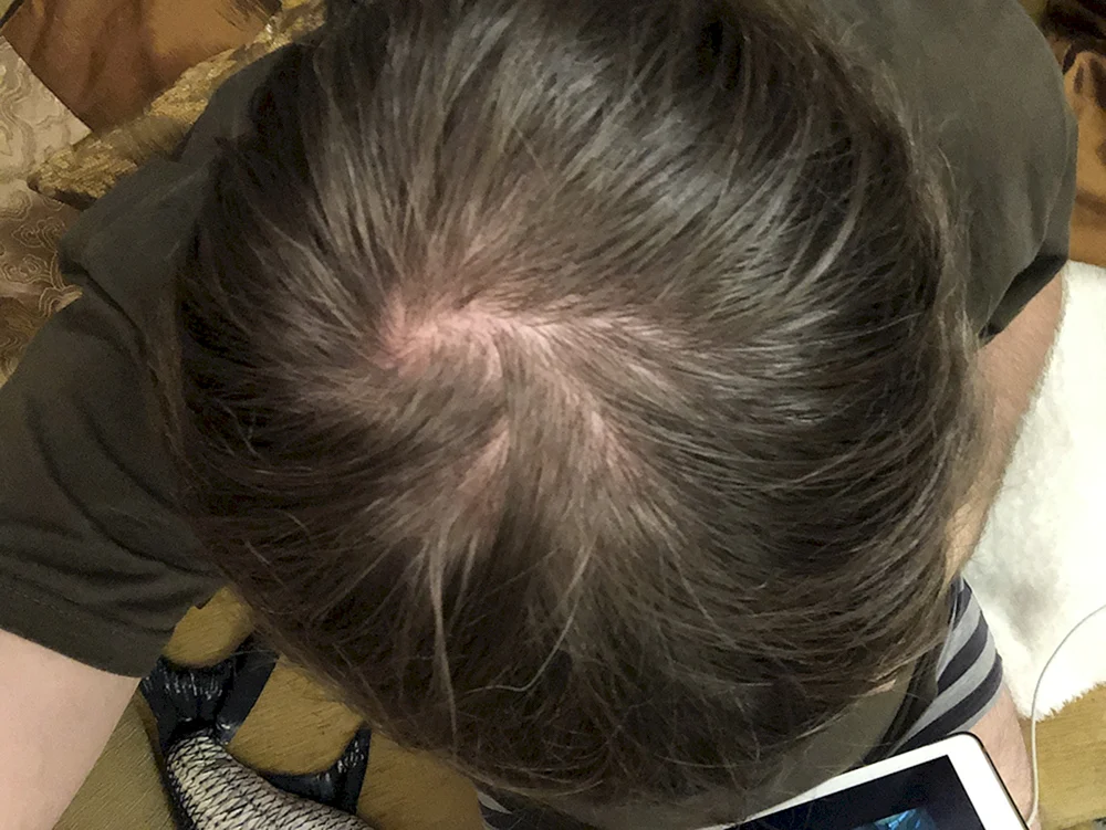 Haarbänder