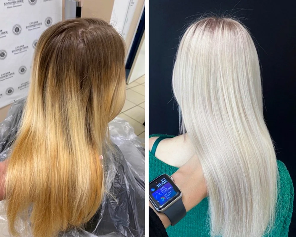 Vorpigmentierung der Haare blond