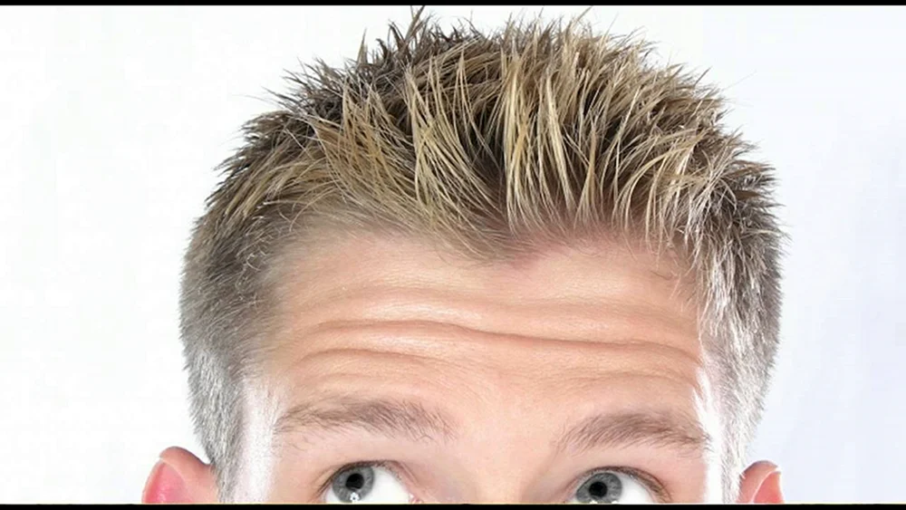 Haarwuchslinie