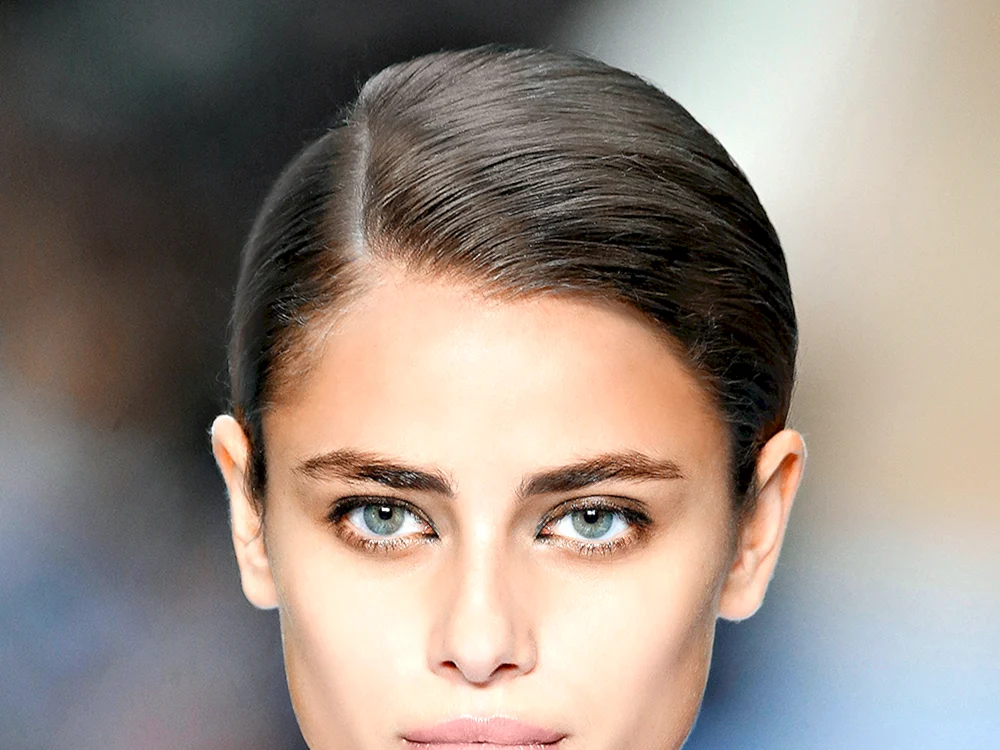 Alopezie androgenetische Alopezie