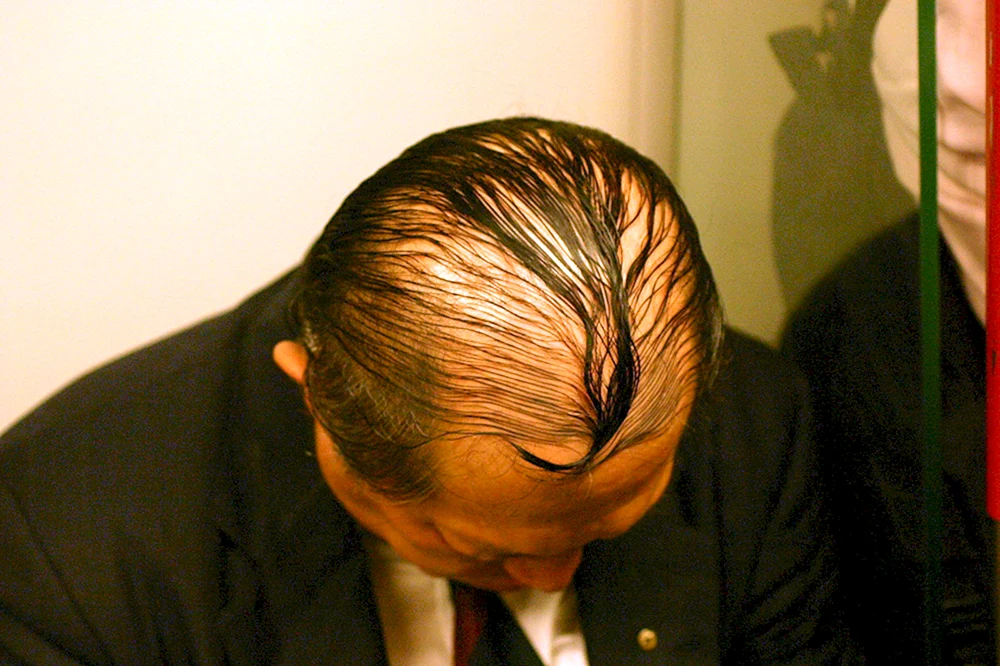 Frisuren Glatze