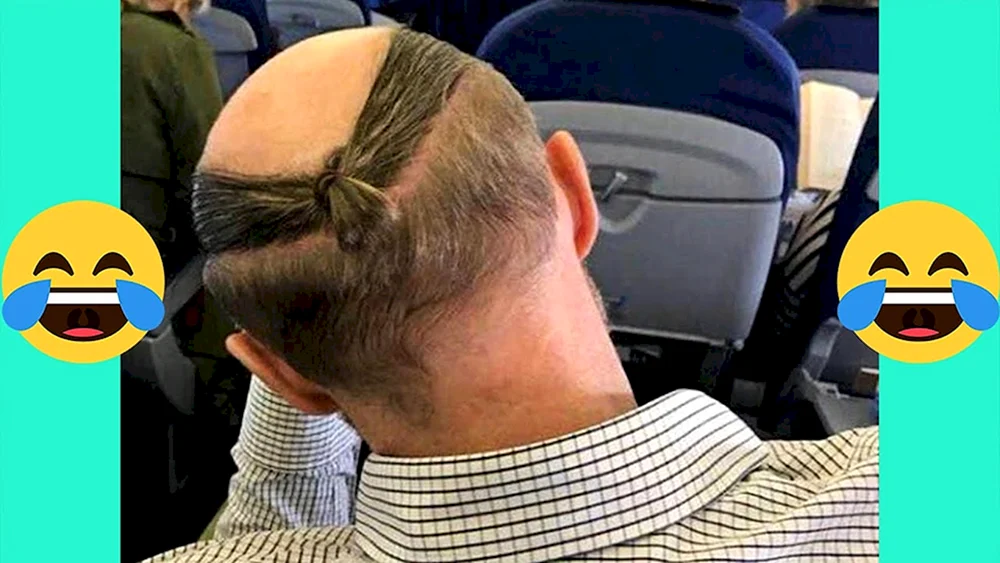 Frisuren mit Glatze