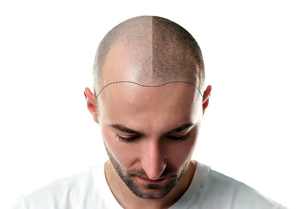 Adam Levine Buzzcut
