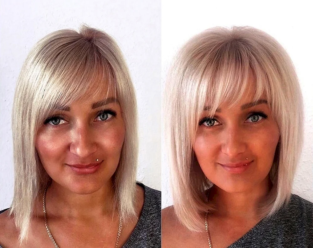 Ring Star Extensions