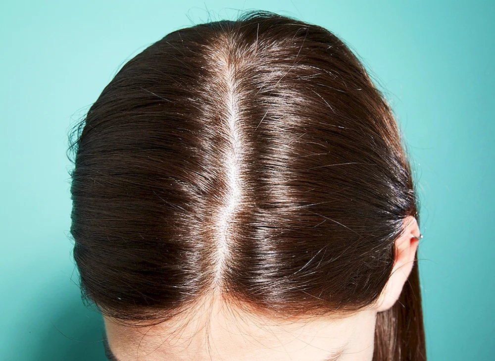 Seltenes Haar