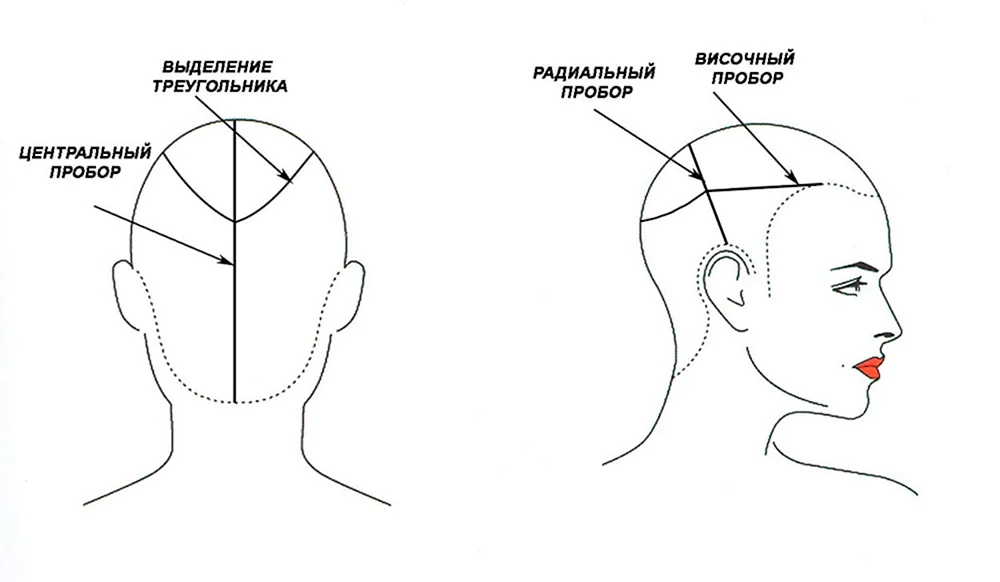 Friseure Kopfformschema