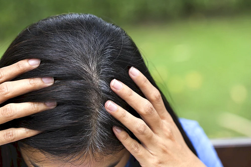 Frühe graue Haare