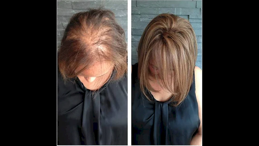 Blond Balayage