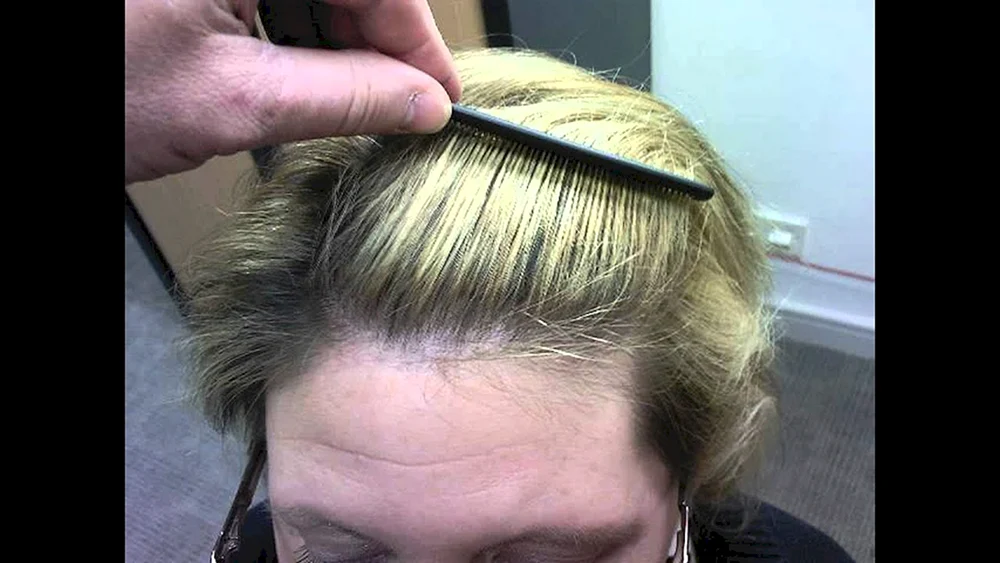 Seltenes Haar