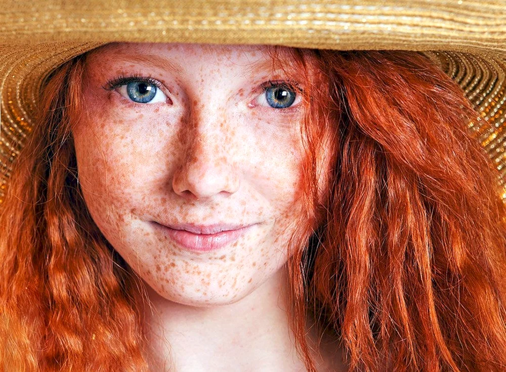 Selina Skinder Sommersprossen