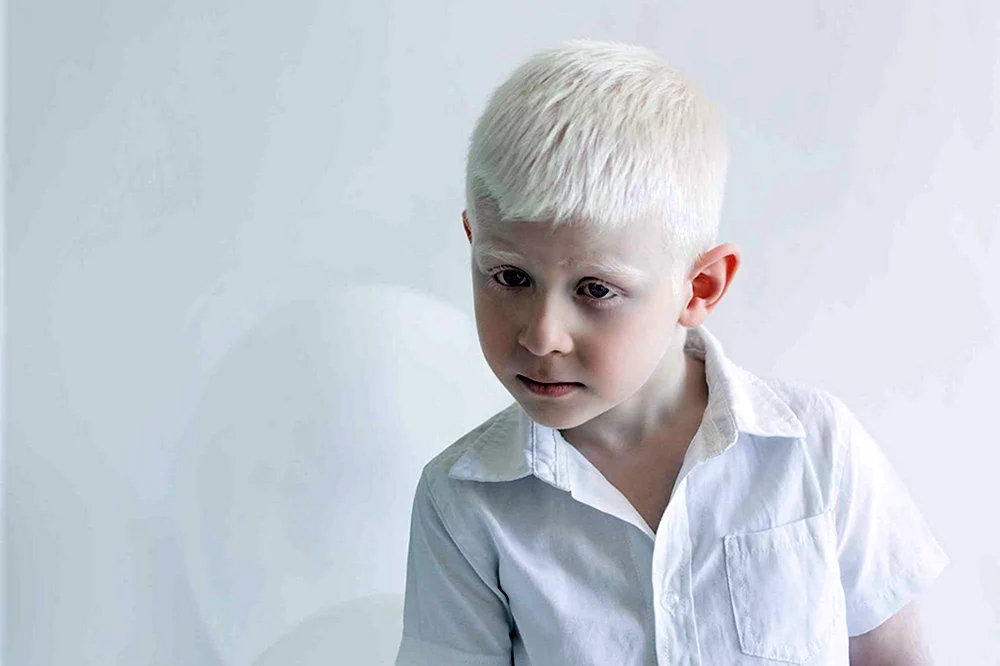 Smirnoff albino