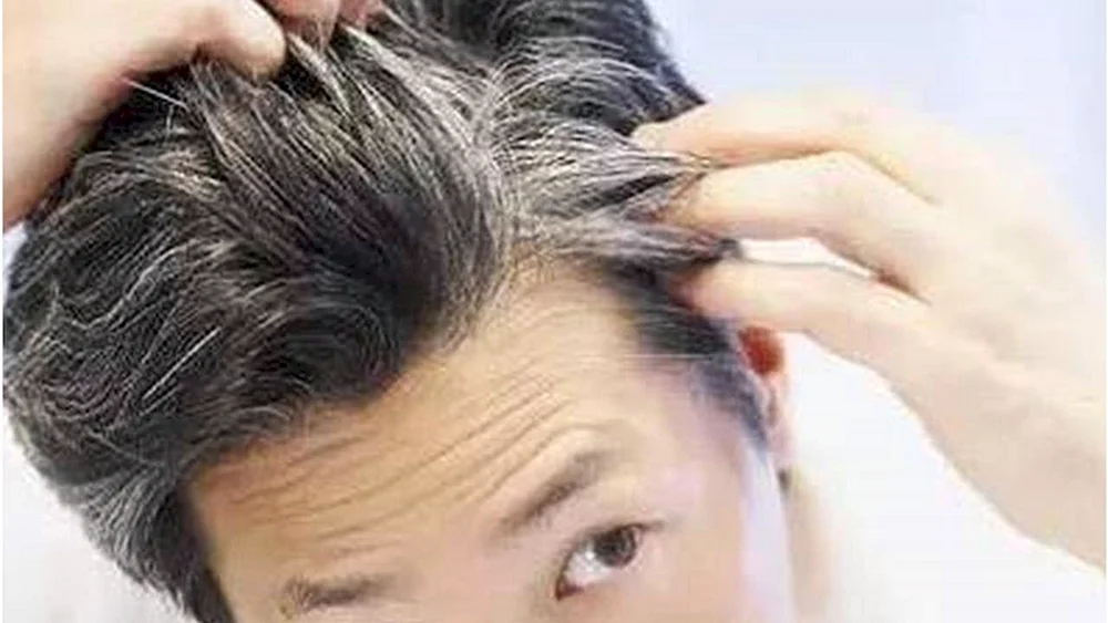 Midnight Hair an den Schläfen