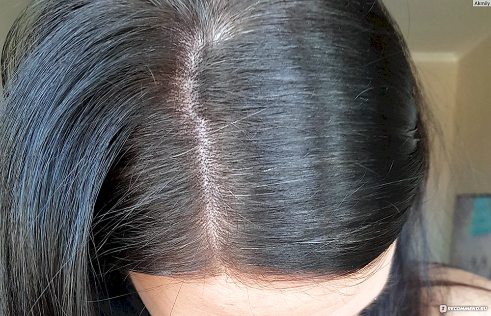 graue Wurzeln auf dunklem Haar