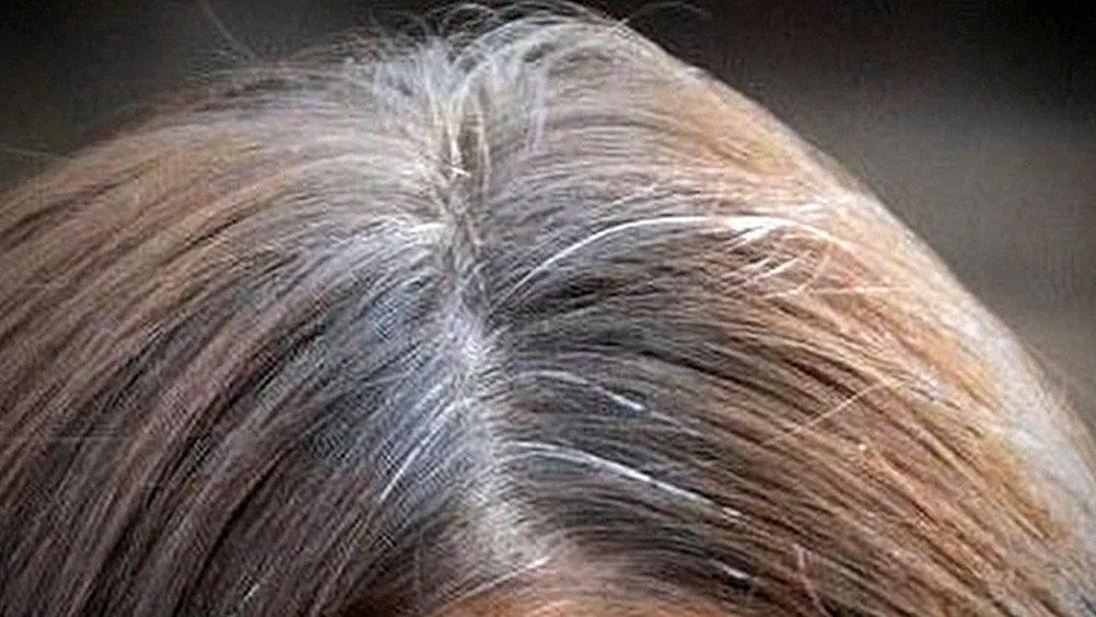 Graues Haar