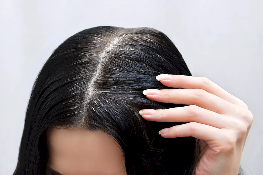 Graue Haare