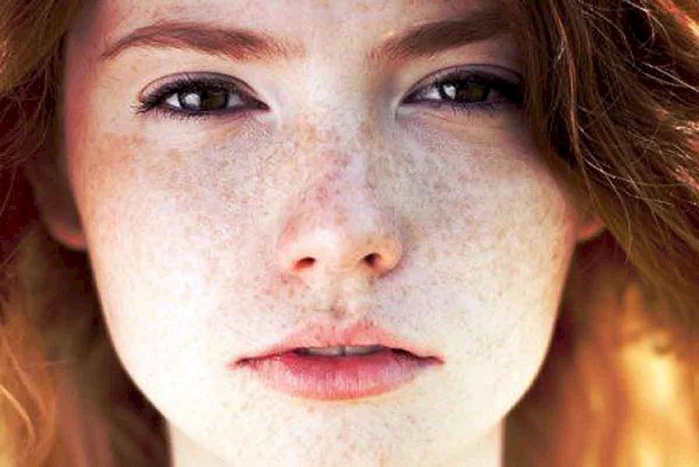 Emma Stone Sommersprossen