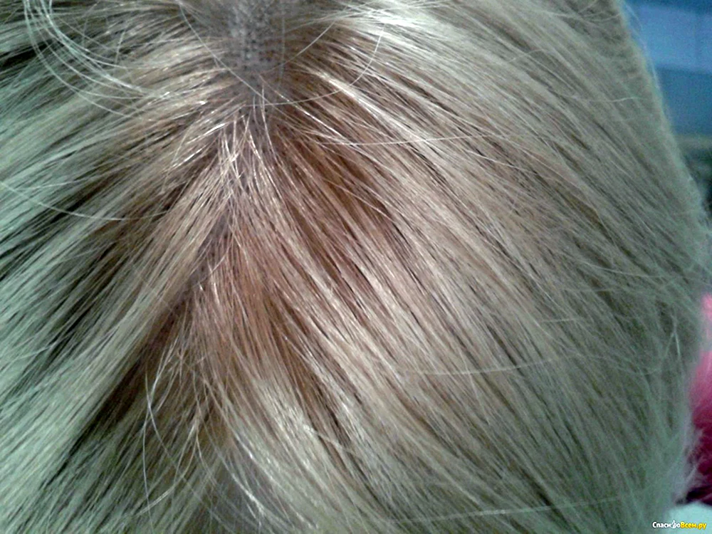 Loreal Erdbeerblond