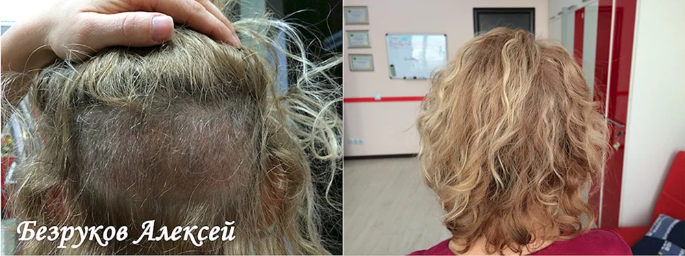 Haar nach dem Bleichen