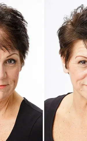 Haarschnitte für schütteres Haar bei Frauen