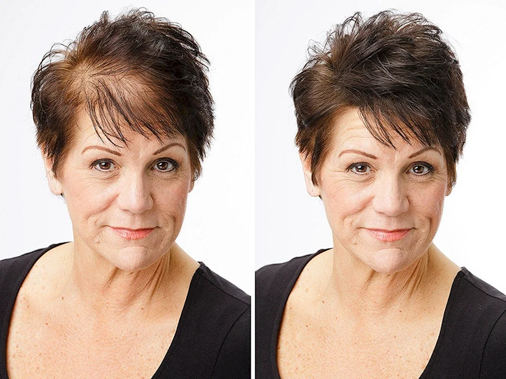 Haarschnitte für schütteres Haar bei Frauen