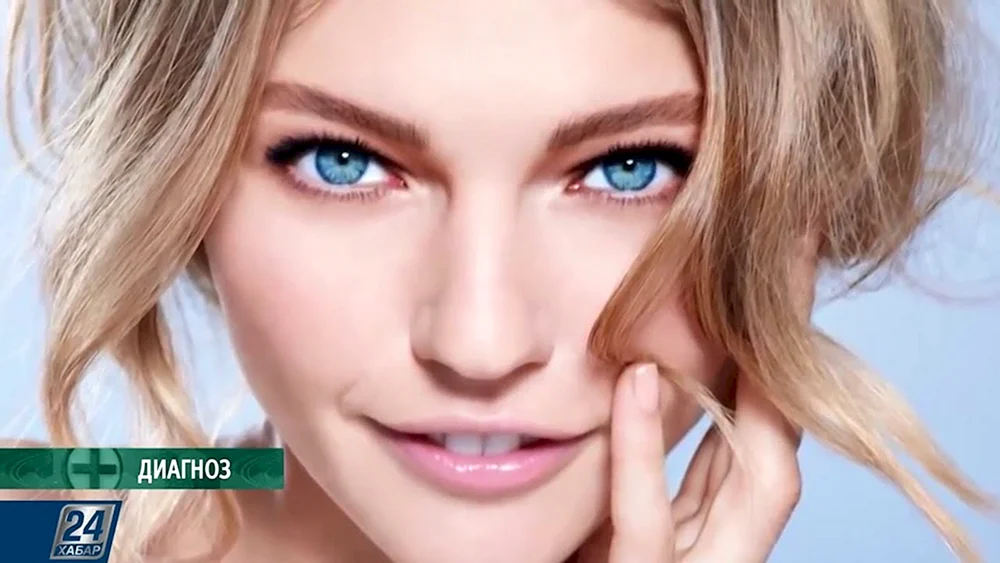 Svetlana Ivanova Heterochromie Augen