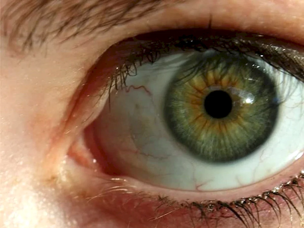 Zentrale Heterochromie Chamäleon