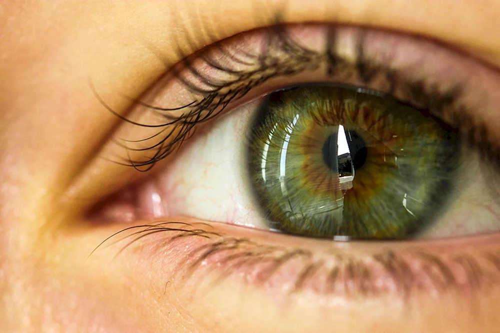 Zentrale Heterochromie grünbraun