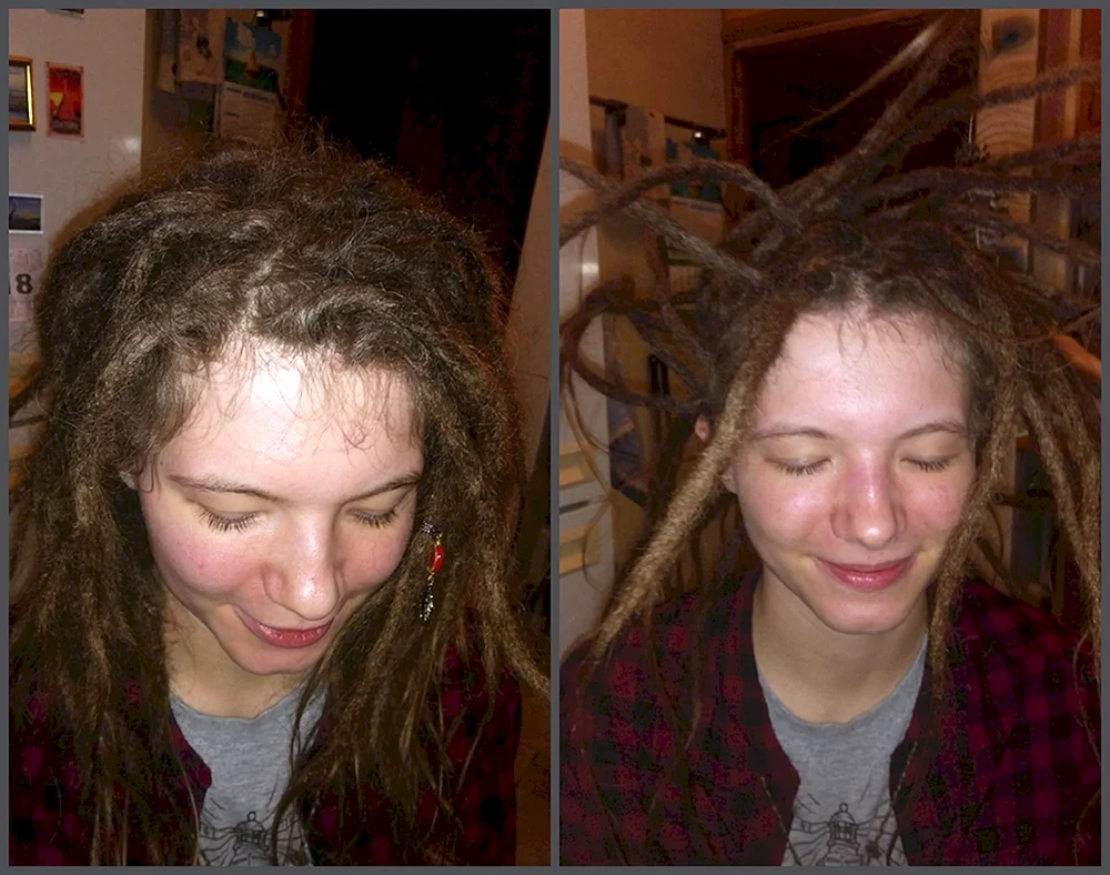 Dreadlocks vor und nach dem Entfernen künstlicher Dreadlocks