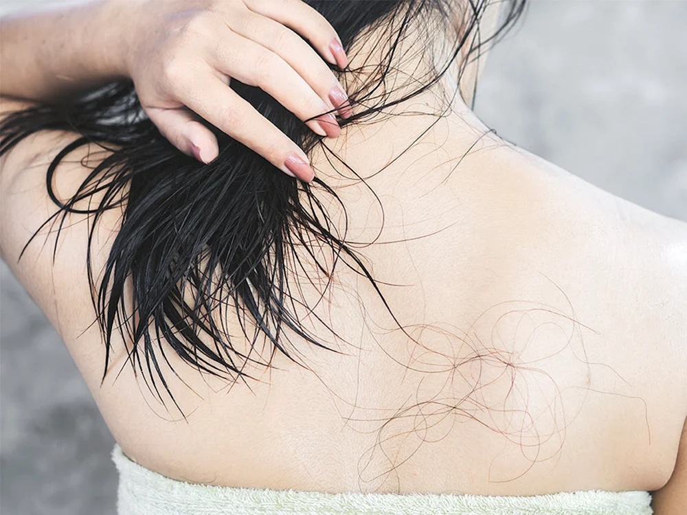 Haariger Rücken bei Frauen