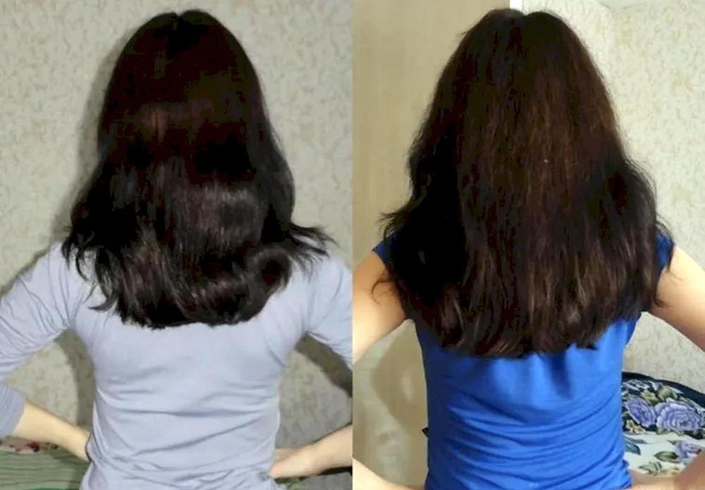 Gewachsene Haare vorher und nachher