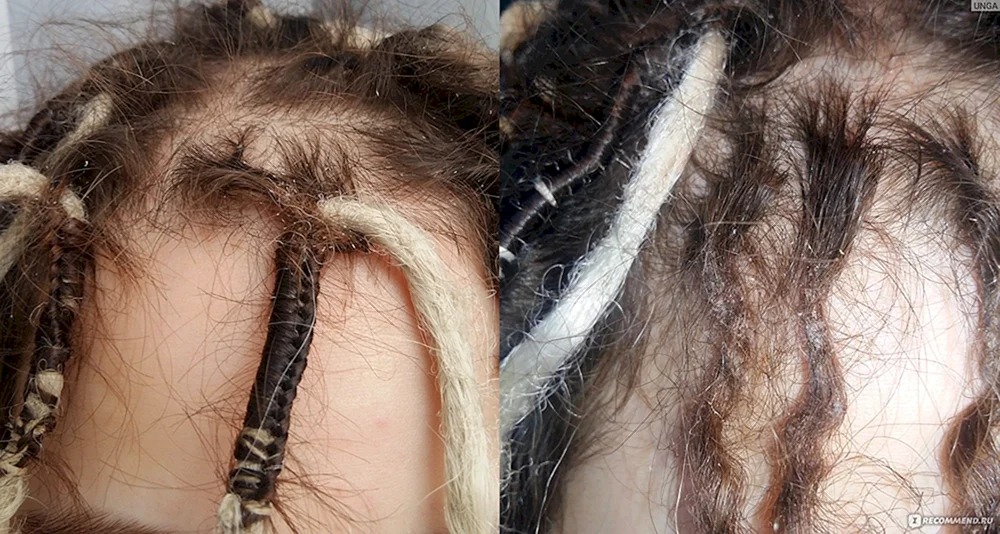 Haar nach Zöpfen