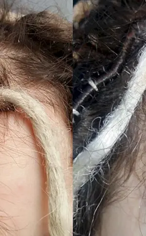 Haare nach Dreadlocks