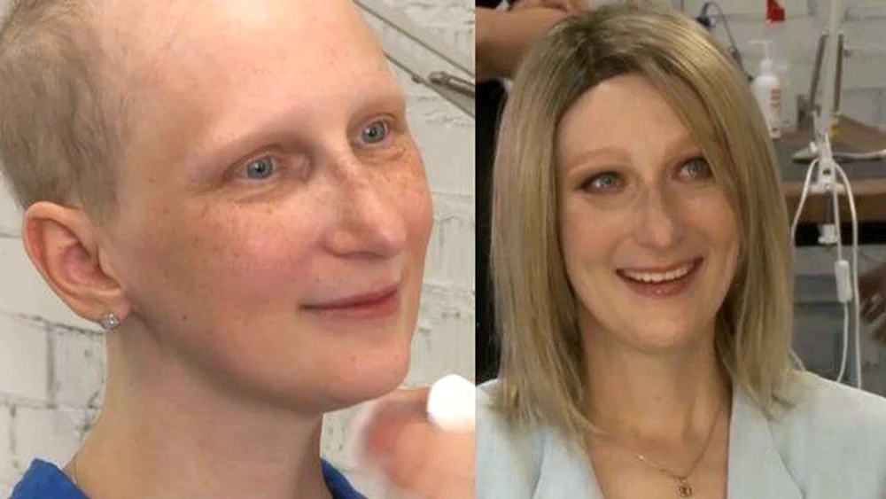 Haarschnitt nach Chemotherapie
